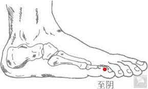 acupuncture - ZHI YIN